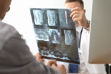 Doctor hold xray bone spine radiography in hand. Examination and treatment of intervertebral...