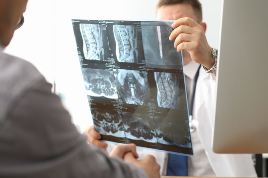 Doctor hold xray bone spine radiography in hand. Examination and treatment of intervertebral hernia. Traumatology tomography hospital radiographer concept.