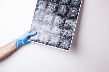MRI image on a white background. Doctor's gloved hand holds a snapshot.