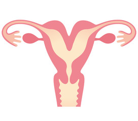 子宮奇形　双角子宮