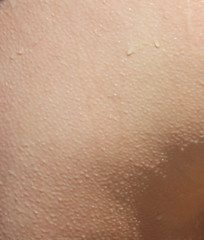Human skin with drops of water as an abstract background