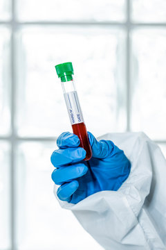 Biologist working with blood samples in the lab