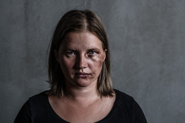 Portrait of the woman victim of domestic violence and abuse - obrazy, fototapety, plakaty