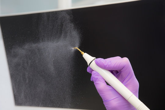 Ultrasonic toothbrushing device, close-up in the dentist's hand. Removal of tartar, plaque. Periodontitis, paradantosis.