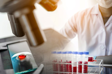 lab technician assistant analyzing a blood sample in test tube at laboratory with microscope....