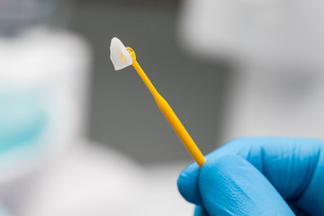 closeup ceramic veneer on a stick in a dentist hand in a blue glove.