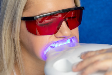 girl with dental caps sitting in a beauty salon for teeth whitening procedure. procedure in the beauty salon. teeth whitening with ultraviolet light