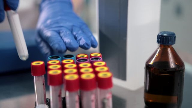 medicine, test tube with colored caps, standing next to a jar of medical alcohol