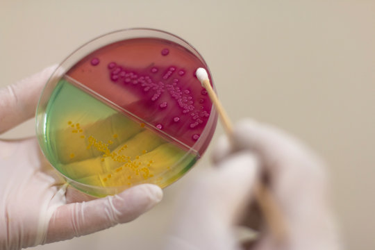 Materiales del Laboratorio de Microbiologia