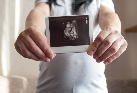 Pregnant woman holds  ultrasound picture of her unborn child. Preparation for childbirth