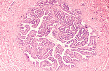 Obraz premium Family Planning: Cross section of human fallopian tube (oviduct) from a tubal ligation, a birth control method in which a segment of the tube is removed surgically, i.e. the tubes are 