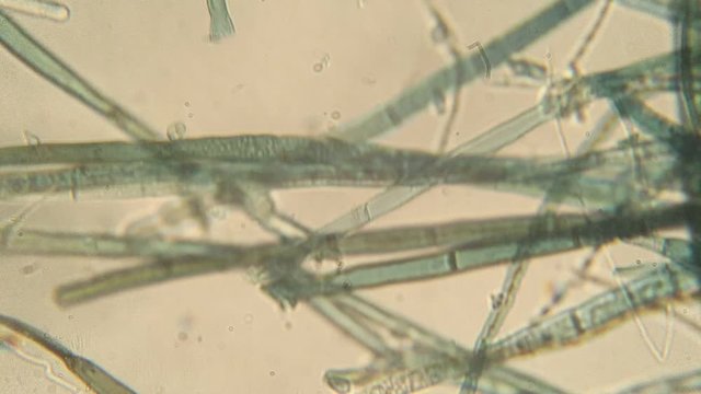 Botrytis cinerea hyphae seen at high magnification under an optical microscope