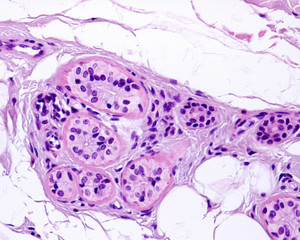 Eccrine gland. Myoepithelial cells