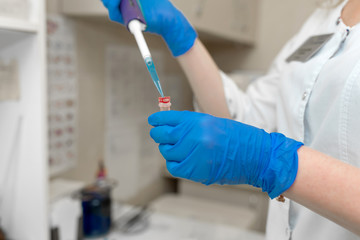 Woman lab technician take blood sample from test tube