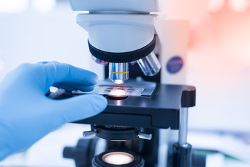 Selective focus technician hand holding urine exam plate and out of focus microscope for scientist diagnosis  at microscopic laboratory department in the hospital.Medical analysis concept.