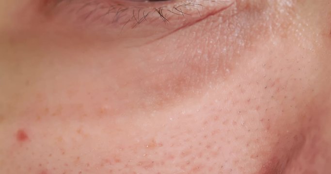 asian woman with dark circle