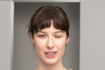 Portrait of a beautiful woman suffering from myasthenia gravis. Half-closed eyelid symptom