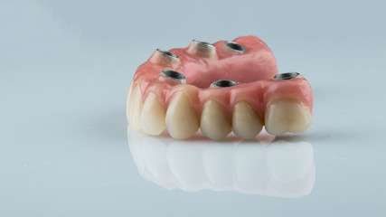 dentures on a white background, dental implants