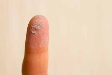 Dust on finger