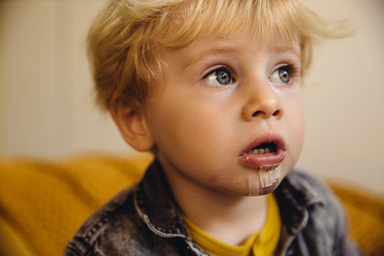 Close up of boy with stitches on chin