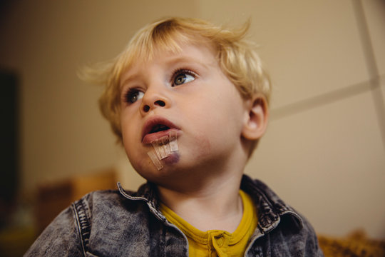 Kleinkind mit gen&auml;hter Wunde am Kinn