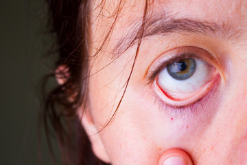 Close up of tired eye
