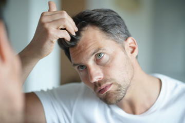 Portrait of a man worried about hair loss - obrazy, fototapety, plakaty
