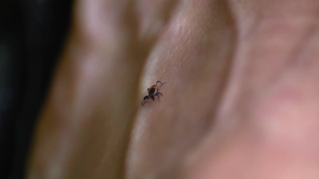 Tick Walking on Human Skin Seeking Place to Feed on Blood