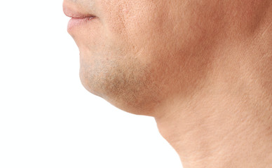 double fat chin