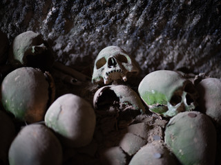 Skull and bones