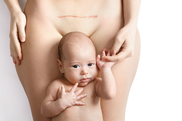 Newborn baby and his mother with a scar after C-Section on her belly