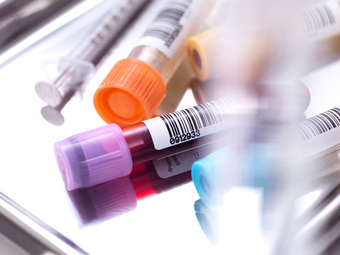 Samples in a tray in a laboratory