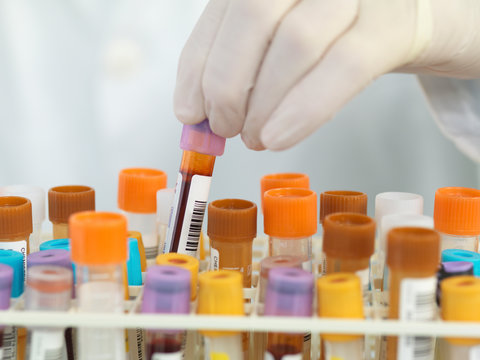 close up of medical technician preparing samples for automated analysis in the lab