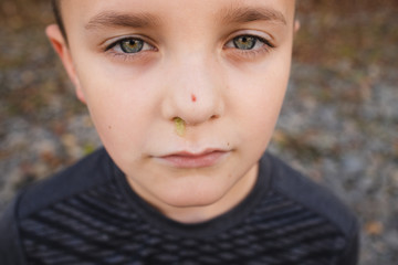 boy with boogers yellow green