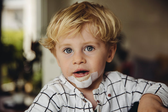 Kleinkind mit gen&auml;hter Wunde und Pflaster am Kinn