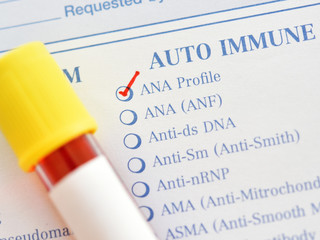 Blood sample for antinuclear antibody or ANA test