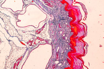 Education anatomy and Histological sample Touch corpuscles in skin Tissue under the microscope.
