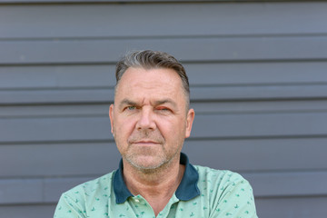 Obraz premium Middle-aged man with swollen inflamed eye