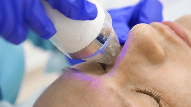 close-up. microneedle RF lifting procedure. Hardware cosmetology. Beautician conducts a facial rejuvenation procedure for a bald woman.