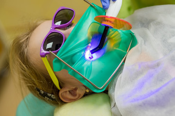 Dentist performing dental filling procedure to preteen girl in pediatric dental clinic. Doctor removing caries using high-speed dental drill. Calm child is sitting in a dental chair holding mouth open