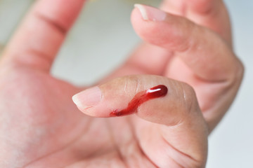 bleeding from incised wound on little finger
