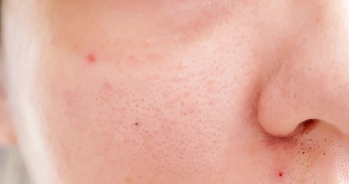 asian woman with dark circle