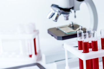 blood in glass tubes on background of microscope