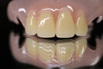 Fototapeta na wymiar 歯