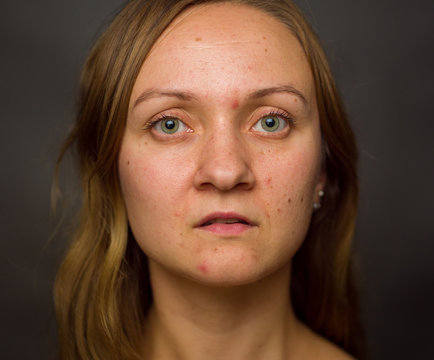 Portrait Of Young Woman, No Make Up, Low Key, Brown Dark Hair, No Retouch Making Expressions