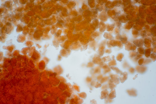 Adipose tissue under microscope view show contains large lipid droplet.