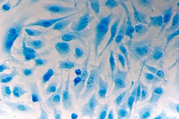 HeLa cervical cancer cells - obrazy, fototapety, plakaty