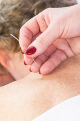 Elderly woman undergoing acupuncture procedure in a spa.