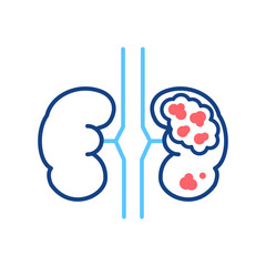 Kidney cancer line color icon. Human organ concept. Malignant neoplasm. Sign for web page, mobile app, button, logo.