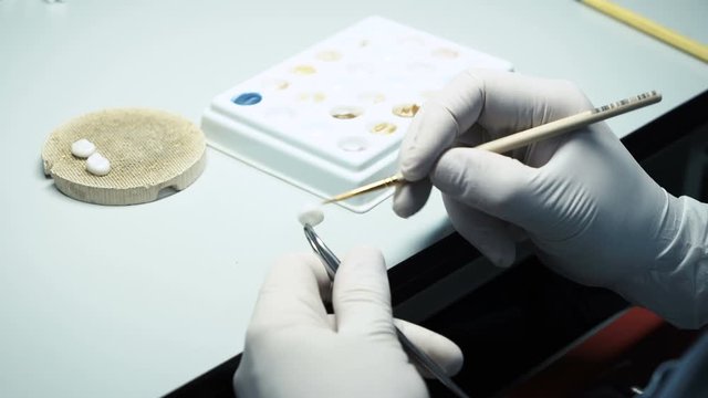 processing and correction of the dental crown. laboratory